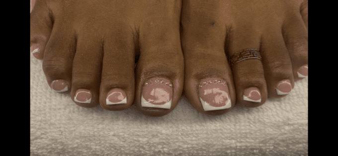 FEET Combo ?
